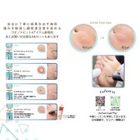 BEAUTY NAILER EF ドクターフットケアビット for ウオノメ HMU-01