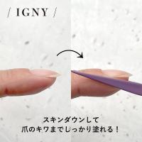 IGNY スキンダウンクリップ 5個入り