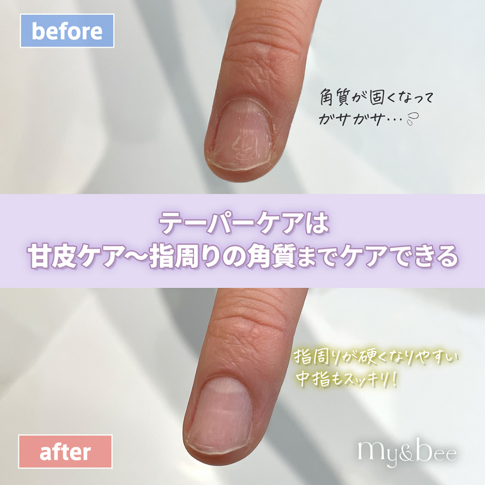 my&bee マイビー テーパーケアフィット M TCF-M