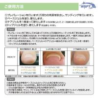 WSPT JAPAN  巻き爪ケア フラットケアジェル 7ml 3本セット