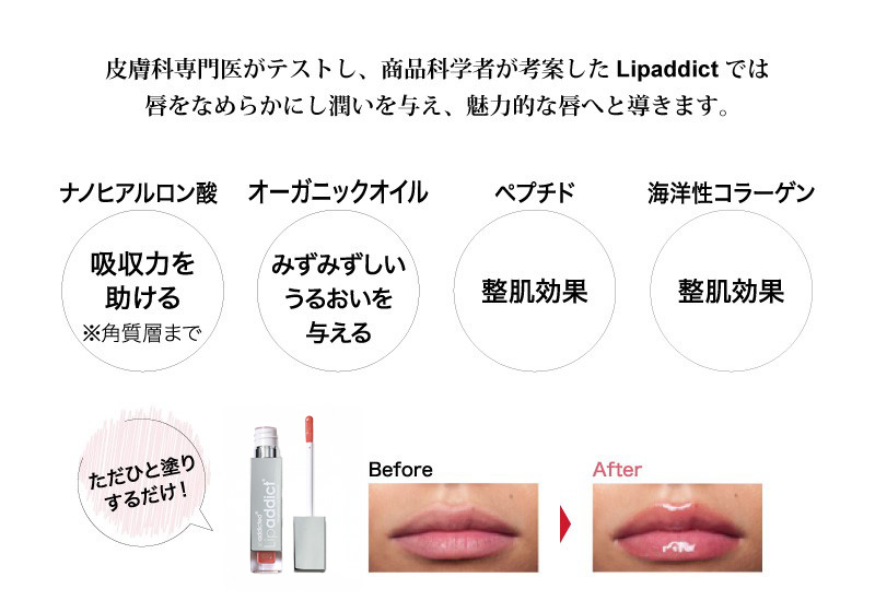 リップアディクト